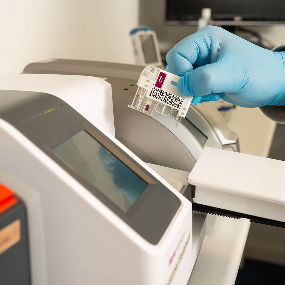 Product validation - Alere Medical Devices Product validation - Alere Medical Devices
